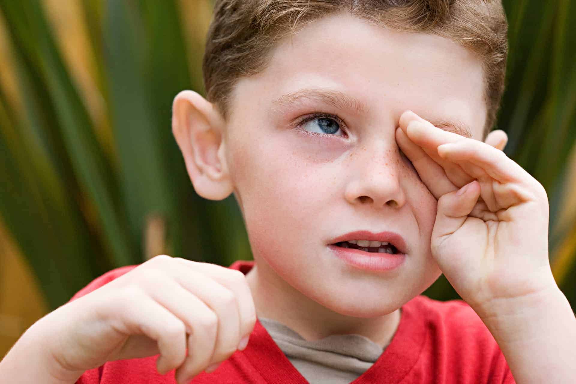 Allergies and Children | Eye Health Library | BC Doctors of Optometry